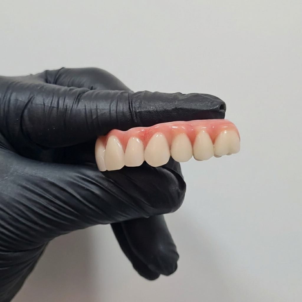 Prótese Protocolo Fixa sobre Implantes - Clínica Isiortho